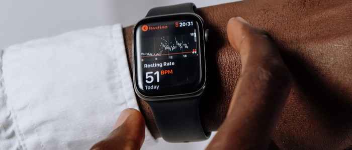 Smartwatch